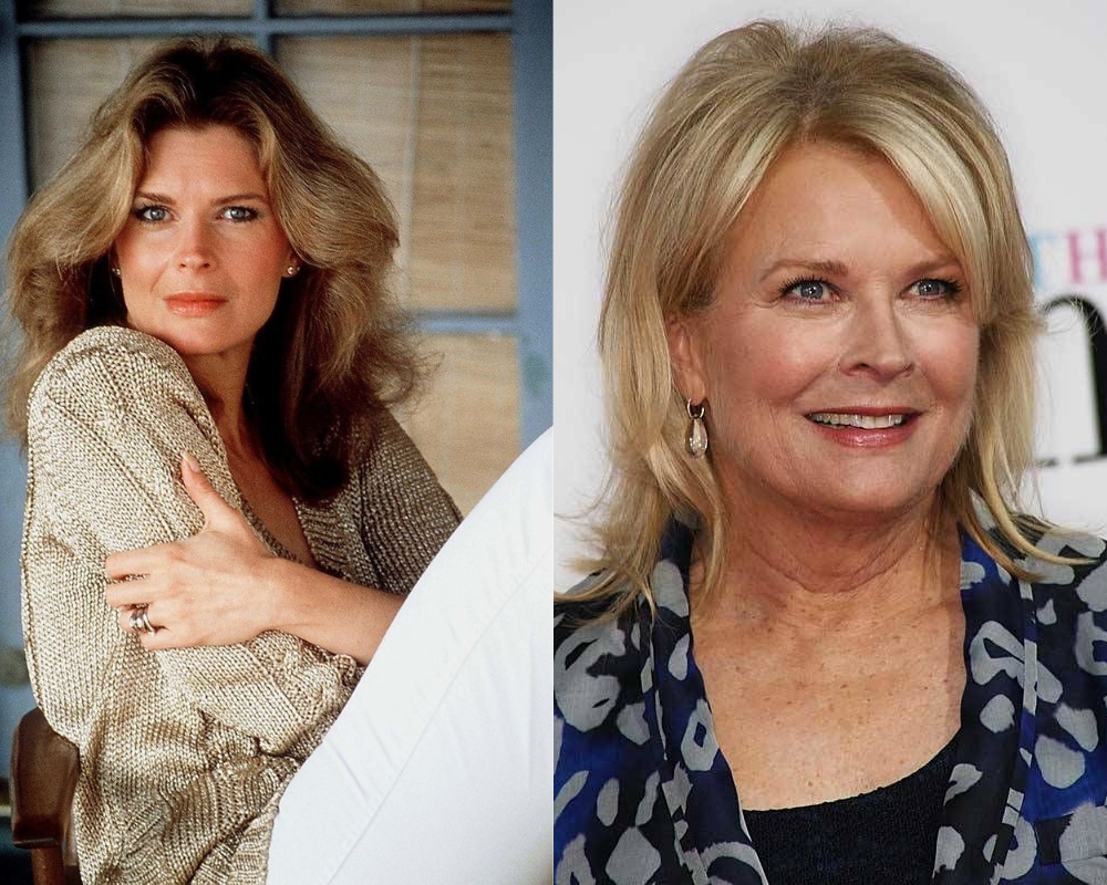Candice Bergen